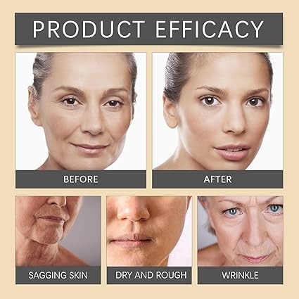 OUHOE Bee Venom Wrinkle Botox Cream